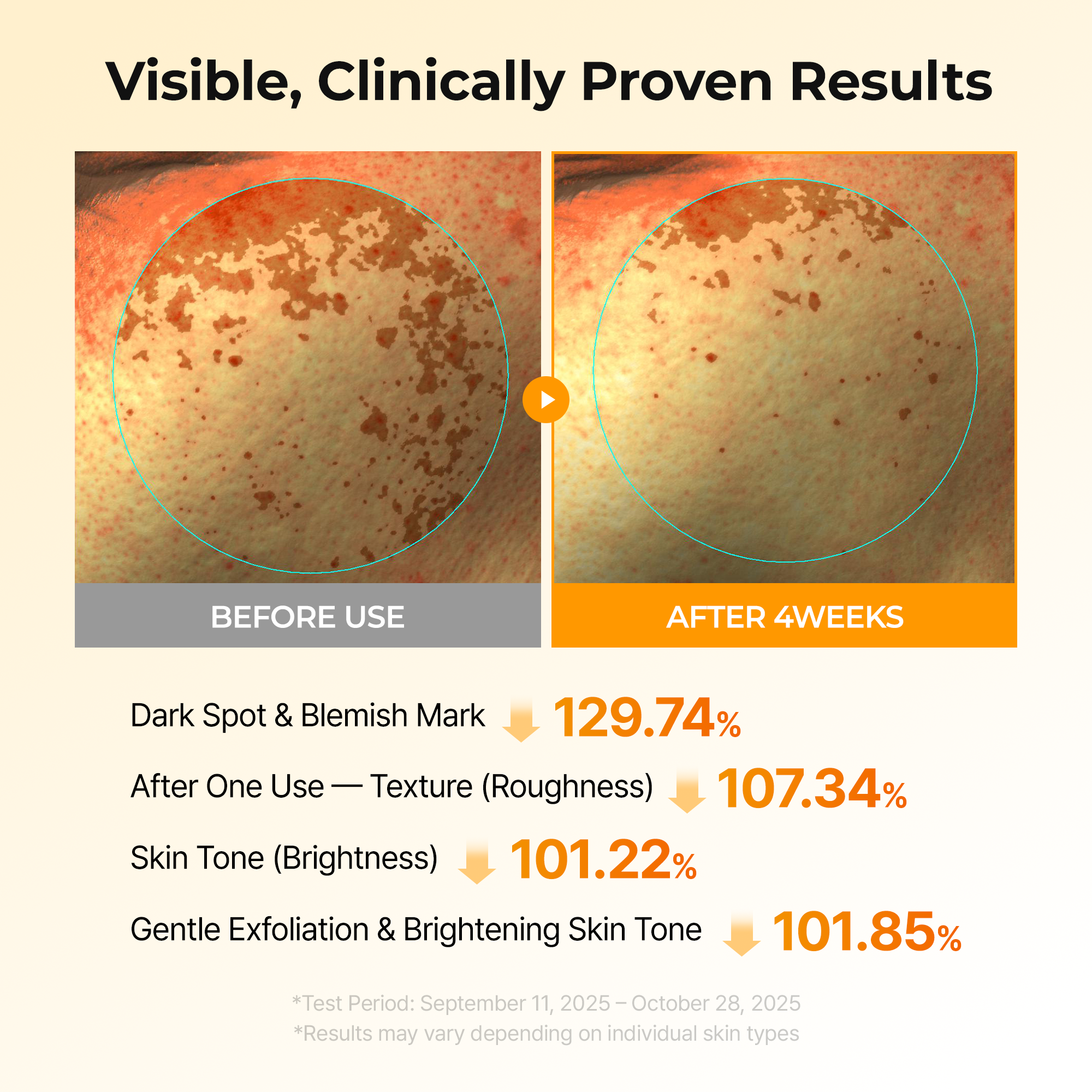 Kojic Acid Turmeric TX Toner Pad 70pads